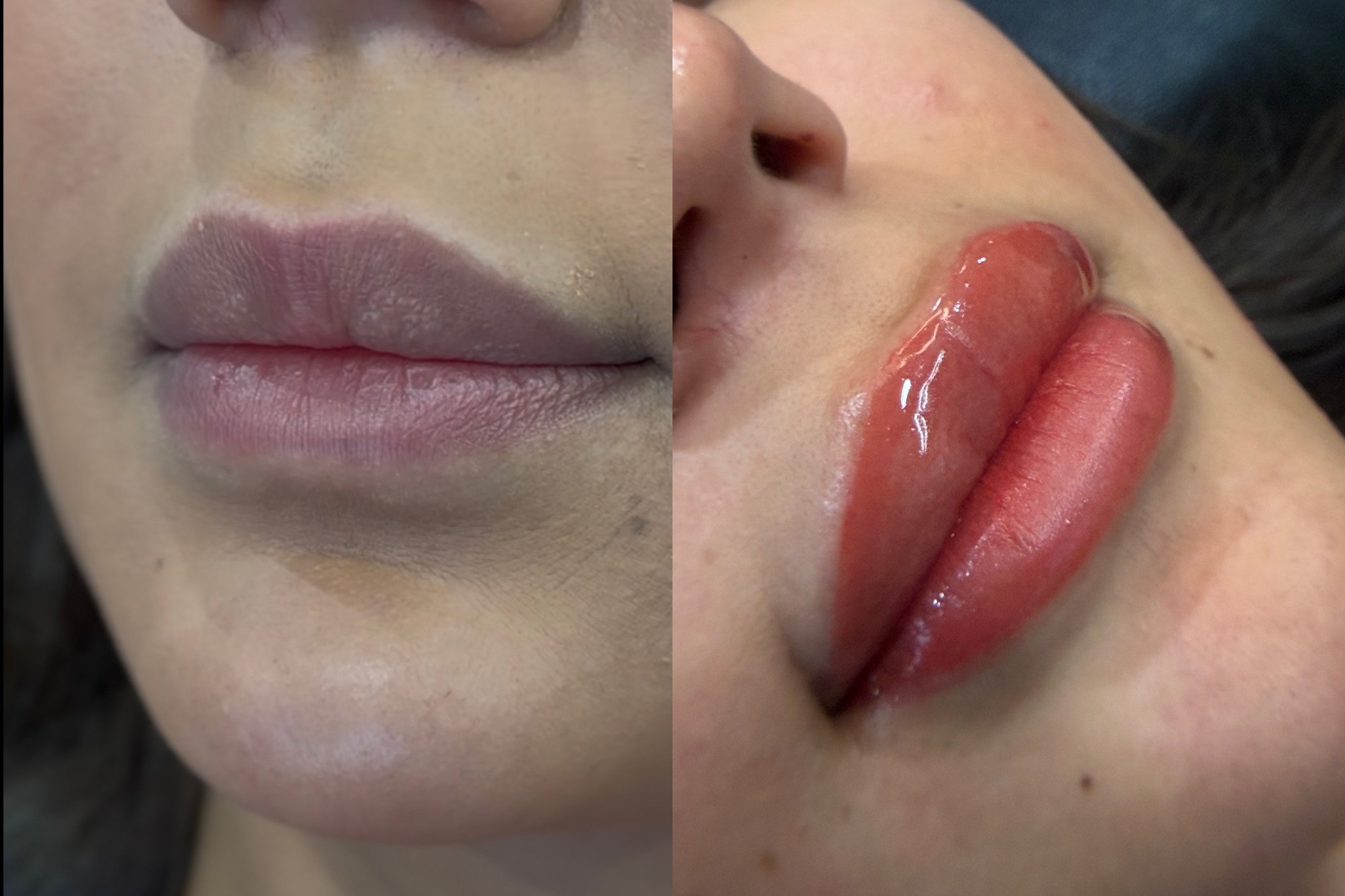 Lip colour correction case study